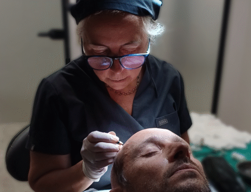 Saç Ekimi Sonrası Nasıl Uyunur ve Neden Önemlidir?