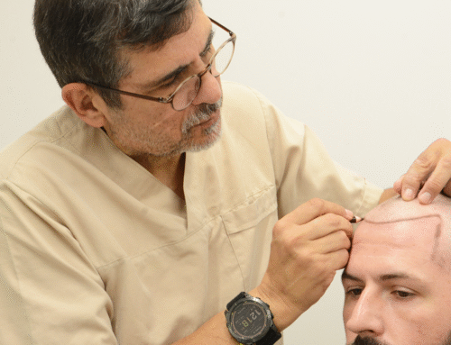 Trikotillomani: Saç Ekimi Çözüm Olabilir mi?