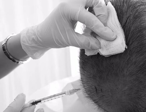 Finasterid’in Psikolojik Belirtileri